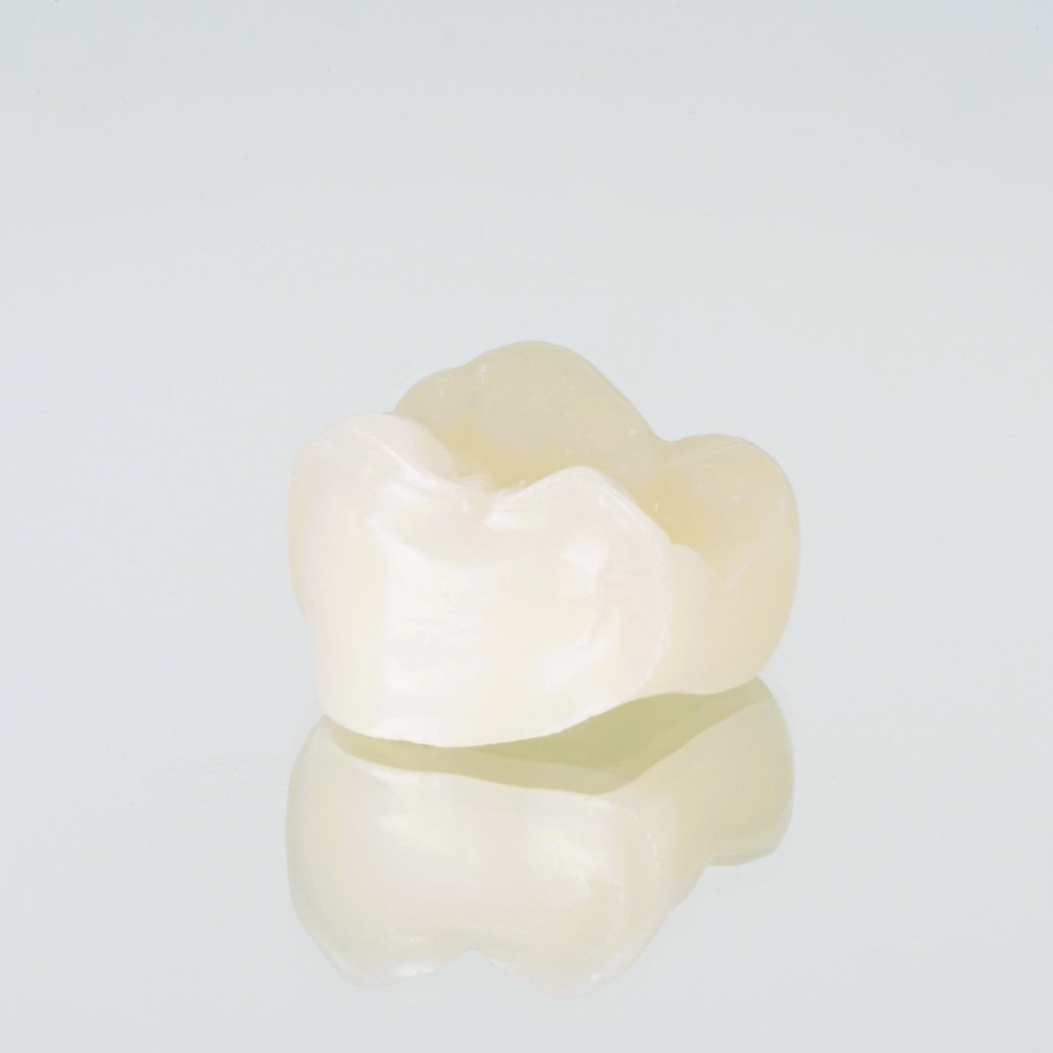 Facial Cutback Zirconia Crowns